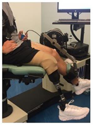 High-Density Electromyography Provides Improved Understanding of Muscle Function for Those With Amputation